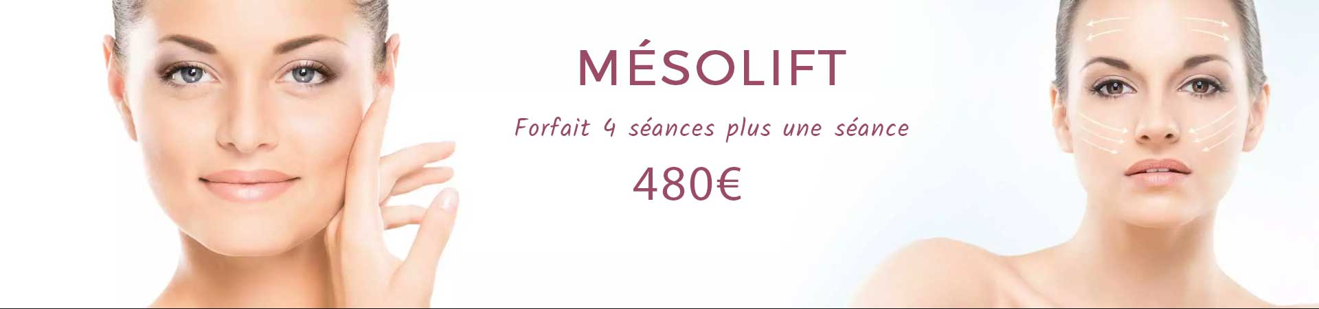 Mésolift à Rouen chez Esthelaz